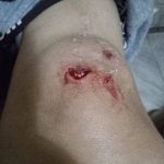 COLÓN: DENUNCIAS POR ATAQUES DE PERROS CALLEJEROS