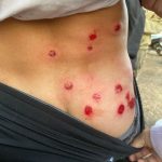 CONFUSO EPISODIO CON PERSECUCIÓN Y BALAS DE GOMA EN COLÓN